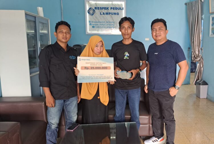 Respek Peduli Beri Bantuan Bayi Kembar Siam Dua Kepala Satu Badan dan Tanpa Anus di Pesawaran