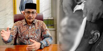 Diduga Akibat Dianiyaya Oknum Polisi, Seorang Warga Aceh Utara Meninggal Dunia, Haji Uma Minta Polda Aceh Tangani Serius