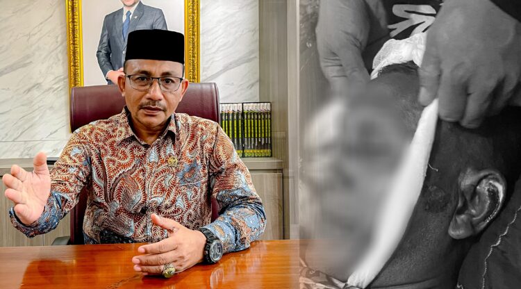 Diduga Akibat Dianiyaya Oknum Polisi, Seorang Warga Aceh Utara Meninggal Dunia, Haji Uma Minta Polda Aceh Tangani Serius