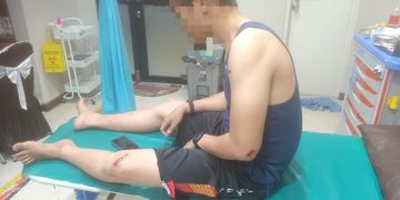 Pencuri Tiang PJU di Cilegon Tabrak Anggota Polsek Ciwandan